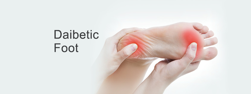 Daibetic-Foot